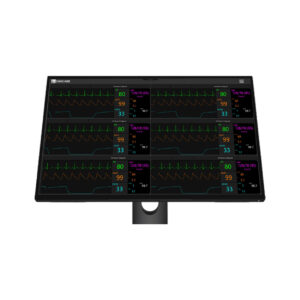 CentralVue CV10x