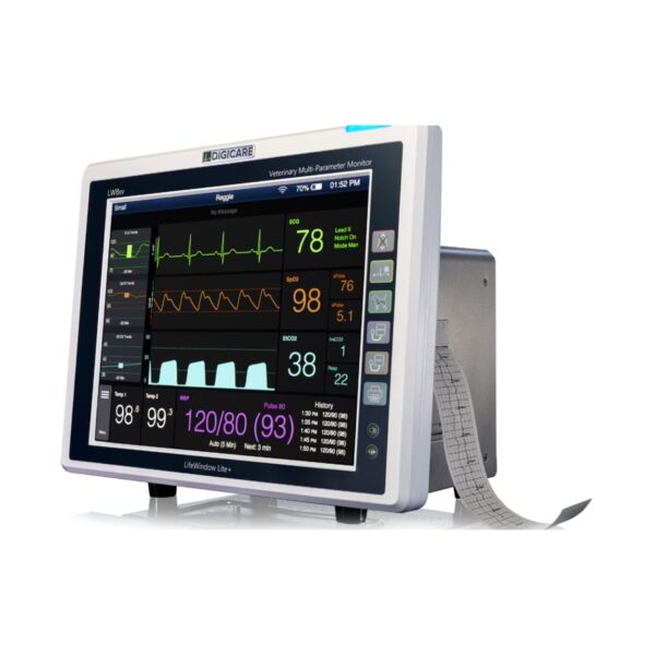 LifeWindow™ Lite Series - Image 4