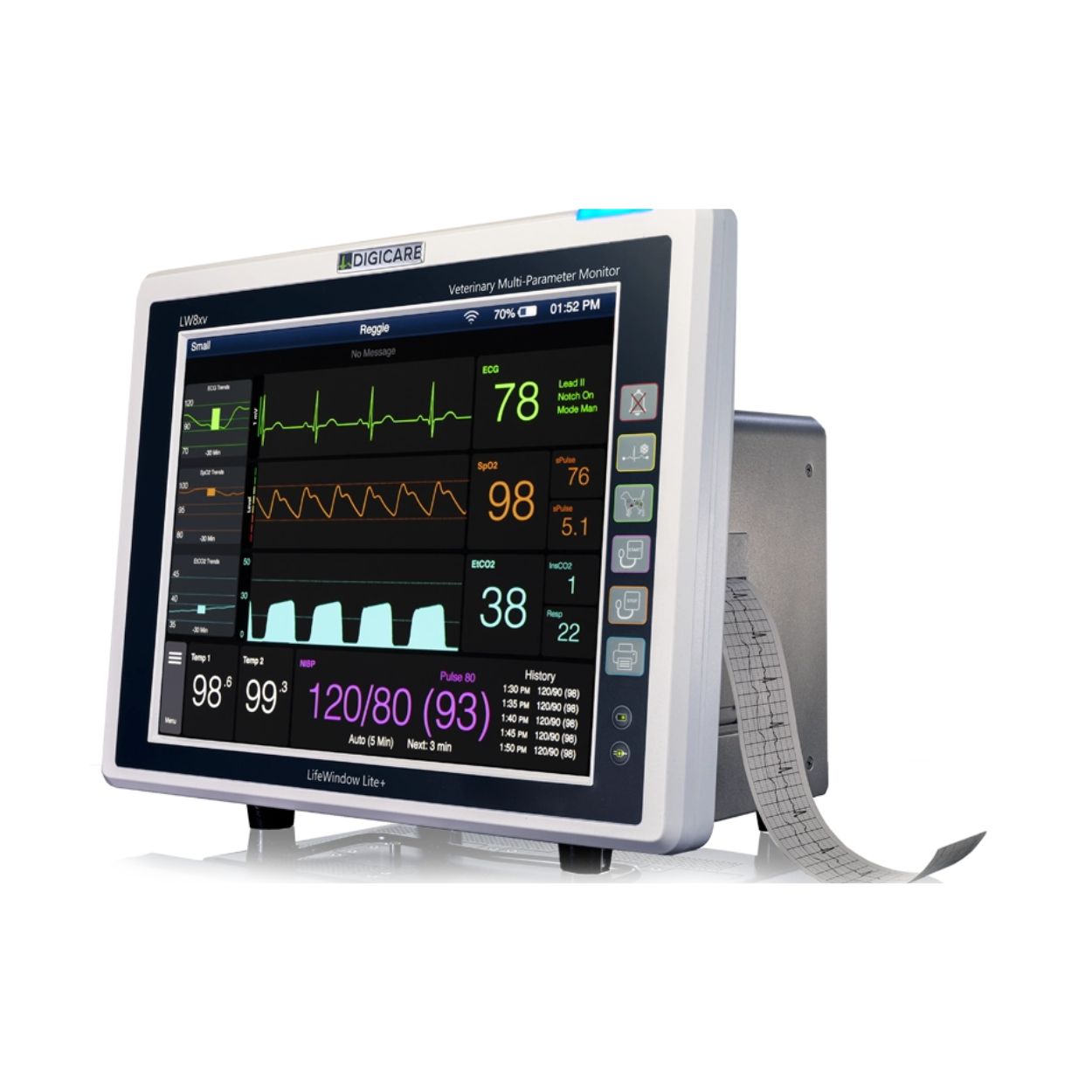 LifeWindow™ Lite Series - Image 4