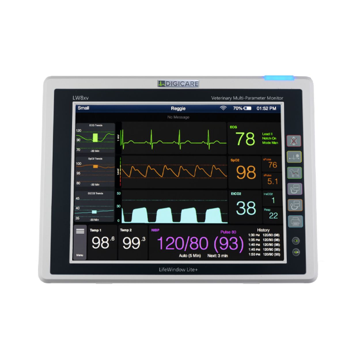 LifeWindow™ Lite Series